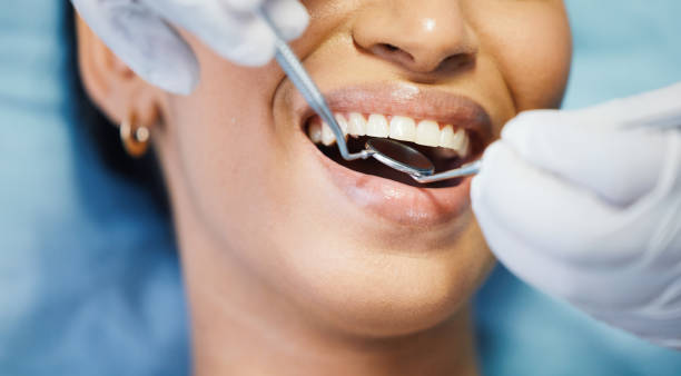 Best Emergency Denture Repair in Shorewood, MN